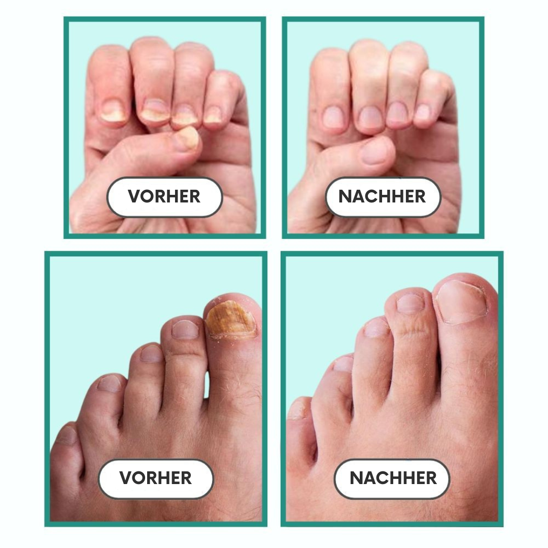 1x BIG Appareil PRINCIPAL-