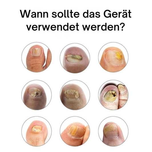 1x BIG Appareil PRINCIPAL-